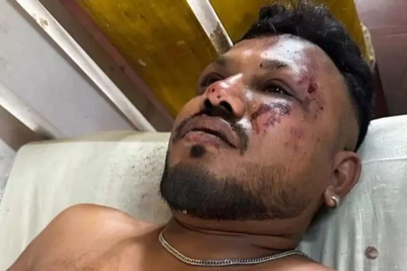 Miracle on Air India flight as ‘seat 11A’ passenger walks away from crash
